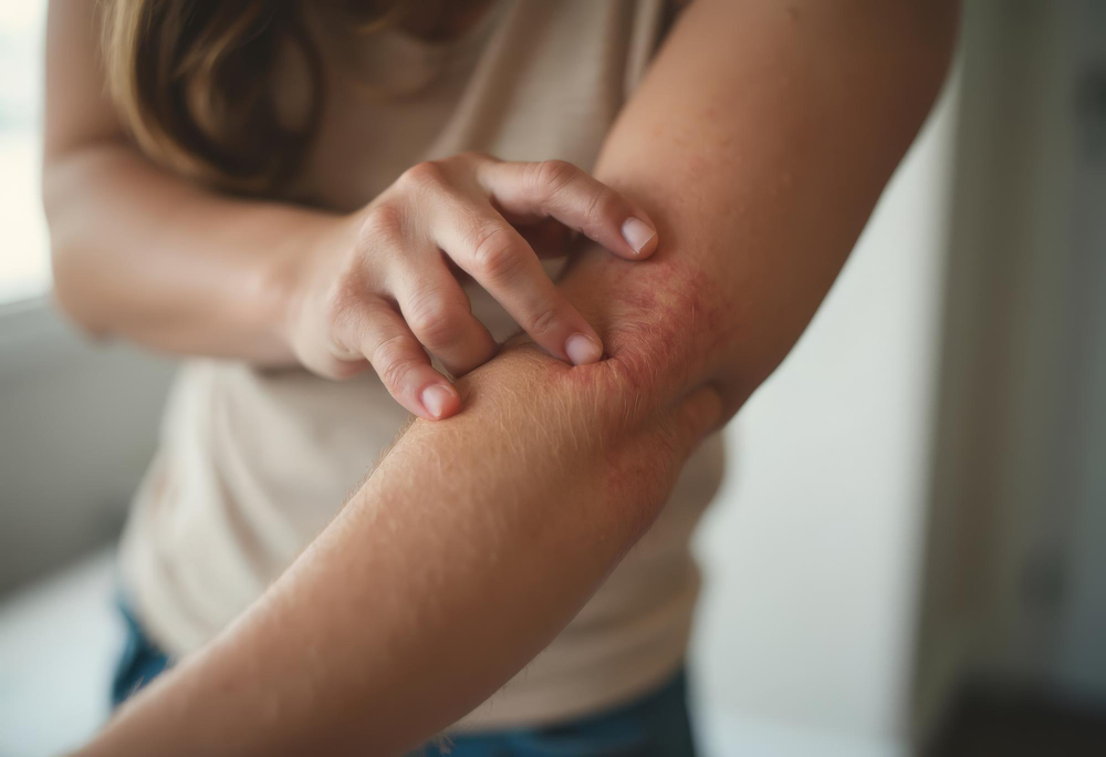 Imagem relacionada a dermatites e alergias da pele